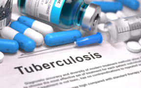 Tuberculosis
