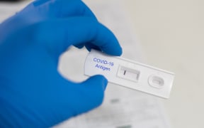 Strip Screening rapid test COVID-19 antigen negative.Testing in biosafty cabinet class 3.