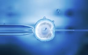 A new artificial intelligence approach to IVF could improve the rate of success and minimize the risk of multiple pregnancies.