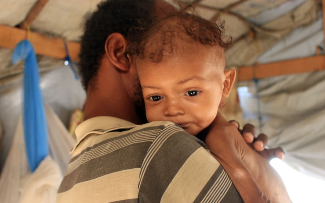 Three-year-old Yemeni child Randa Ali, suffering from severe acute malnutrition, is carried by her father in Al-Khudash camp for displaced people in the Abs district of Yemen's northwestern Hajjah governorate, on 19 February, 2022.