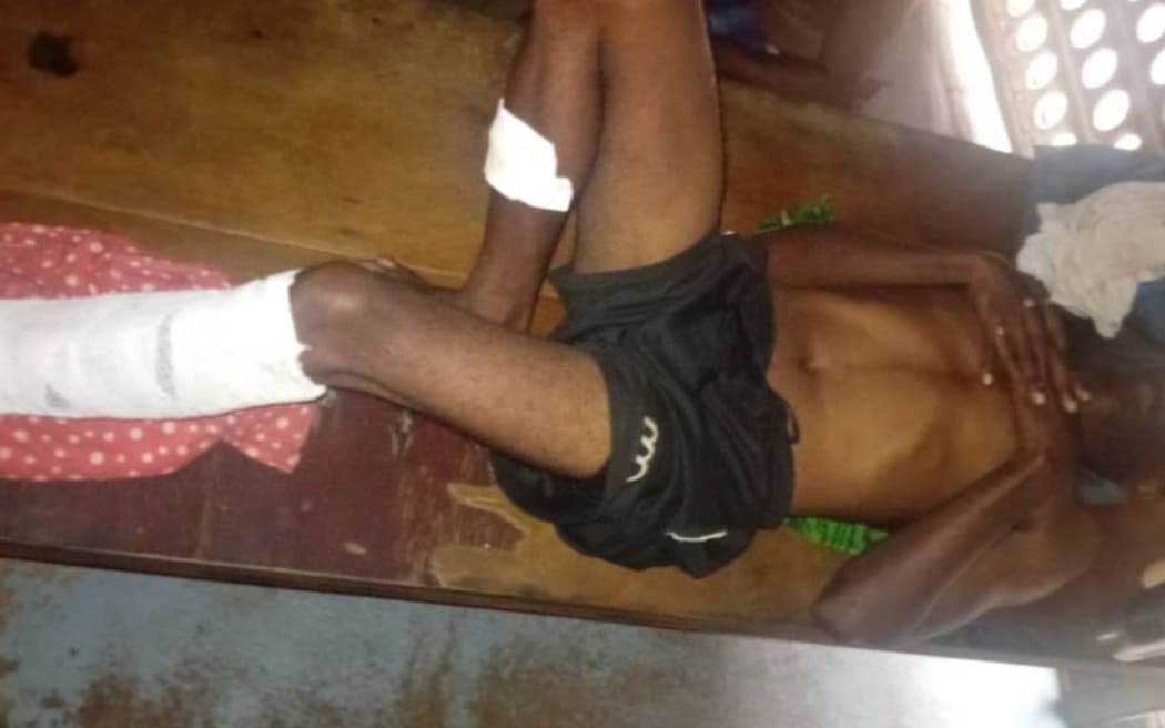 An injured inmate at Papua New Guinea's Bomana Prison.