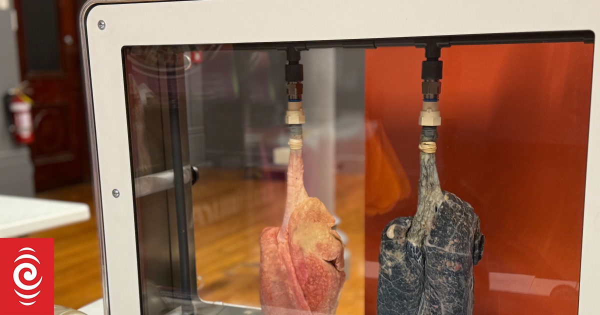 'Diseased lungs, ageing by nicotine': Exhibition tackles risks of smoking, vaping - Vimarsana News