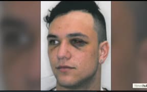 Newshub airs a Police photo of injuries sustained by one of Losi Filipo's four victims.