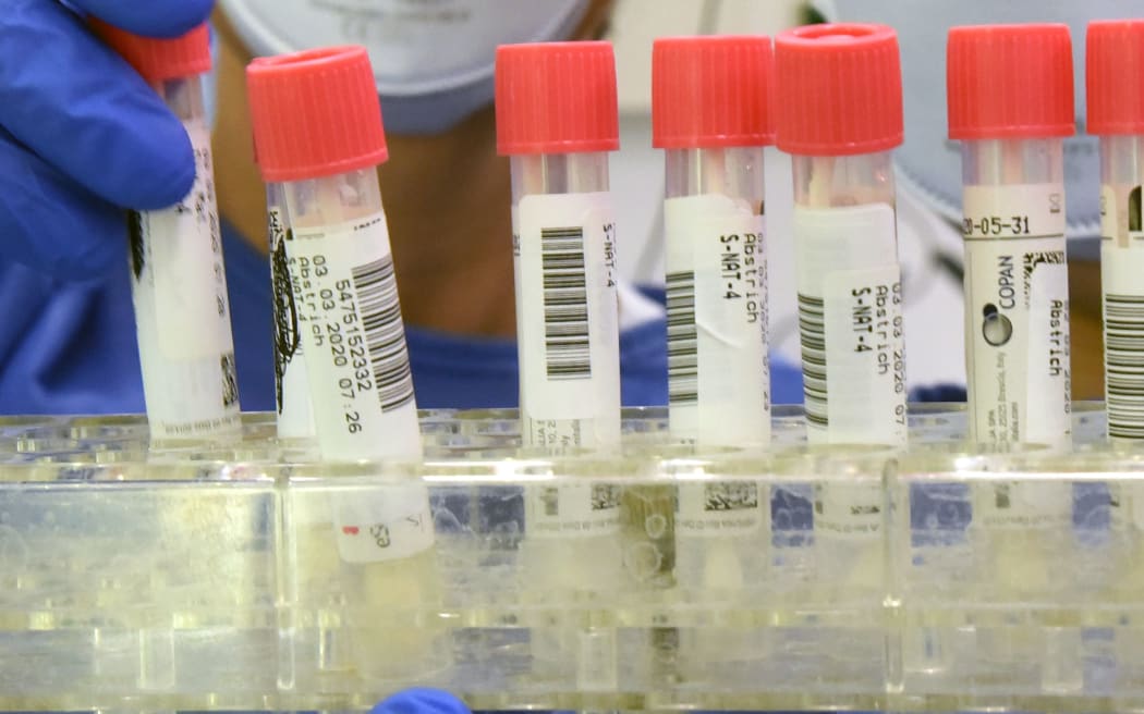 Patient samples at a safety workbench for coronavirus testing.