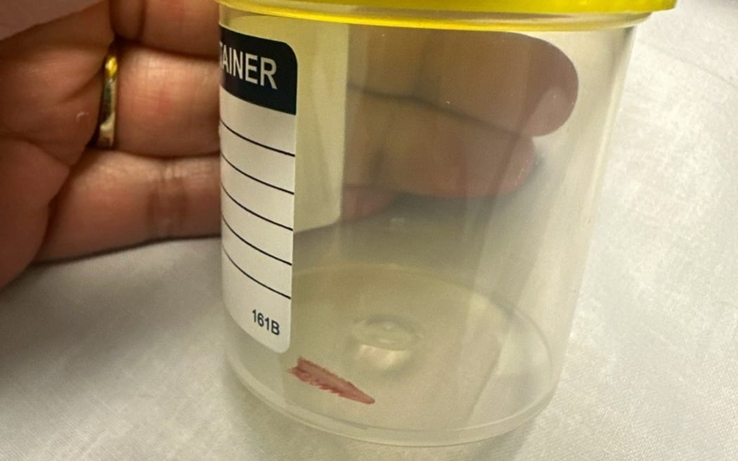 Stingray barb