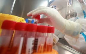 This photo taken on August 13, 2021 shows a laboratory technician wearing personal protective equipment (PPE) working on samples to be tested for the Covid-19 coronavirus at a Covid-19 testing facility in Yangzhou in China's eastern Jiangsu province.