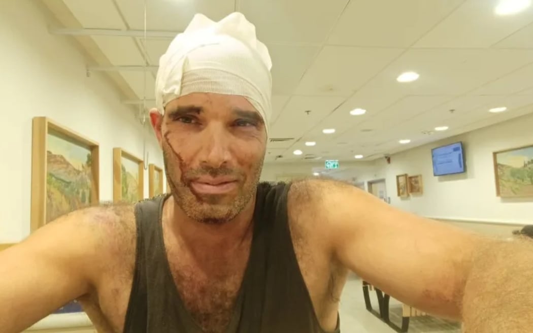 Israeli off-duty officer Yuval Ben Ari was beaten by dozens of settlers on the occupied West Bank, while he was assisting Palestinians in harvesting olives. He was hospitalized and received four stitches.