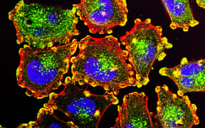 melanoma cells