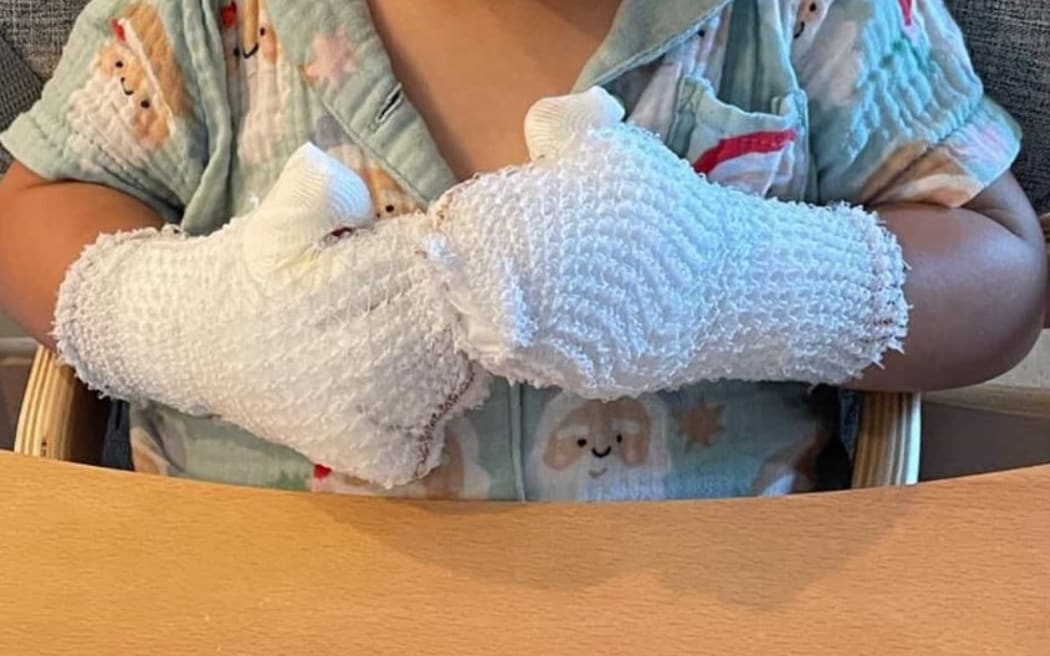 Children are being burned on playground equipment that is scorching hot in the sun.