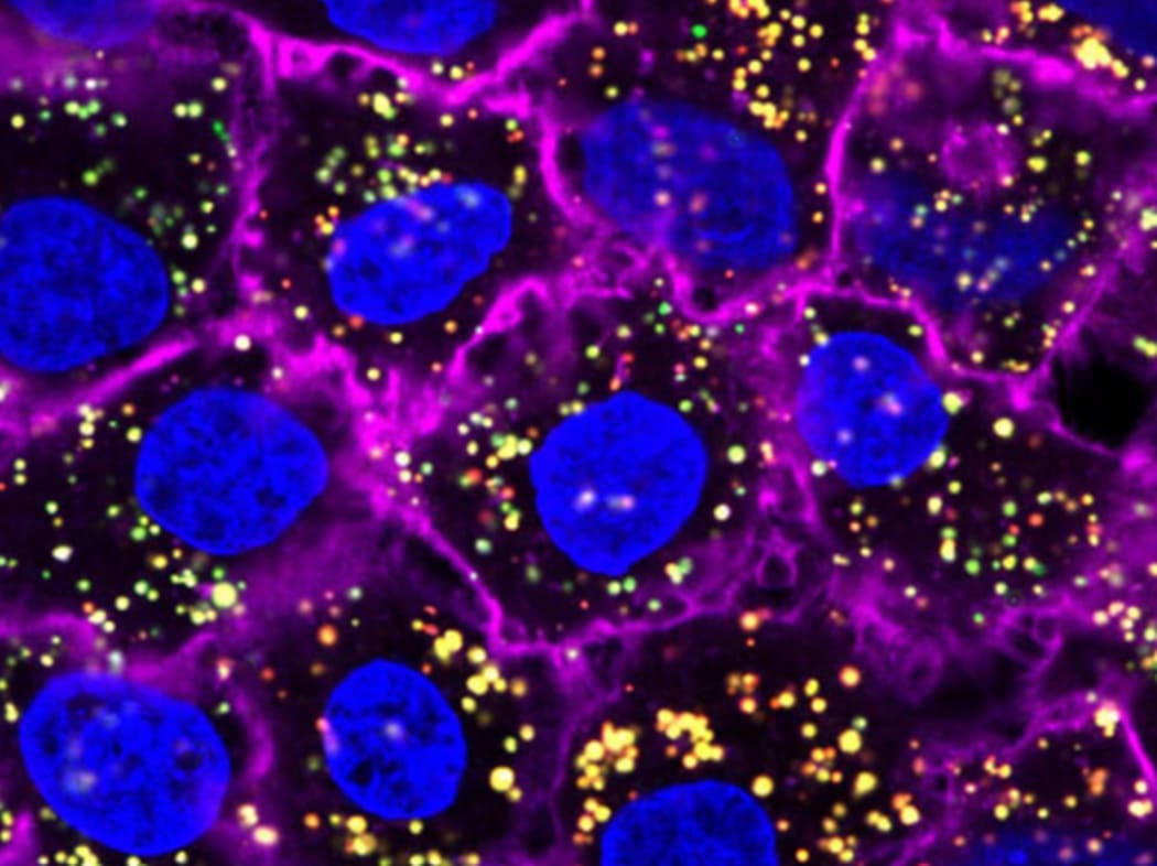 Nanoparticles (yellow) targeting and entering cancer cells (blue)