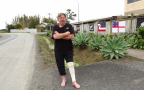 A year after a dog attack that Chris Radich says could have cost his life, the Awanui man still has a bandage on his leg and struggles to walk.