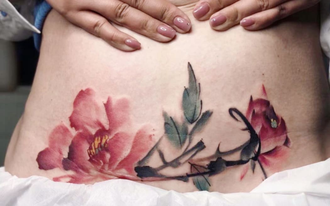 Tattoo artist Xixi's work, a peony to cover the scar of C-section