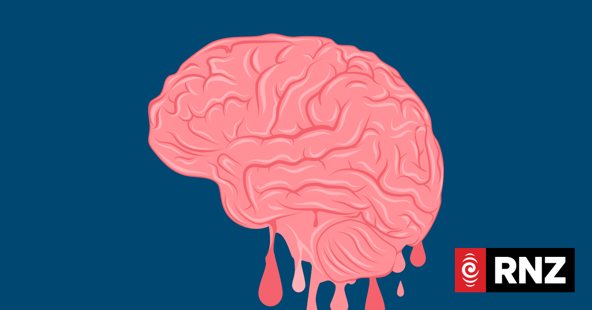 What is Brain Rot, the Oxford Dictionary's Word of the Year? | RNZ