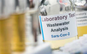 Wastewater samples, analysis of sars-cov-2 virus in patients infected by human coronavirus 229E, conceptual image