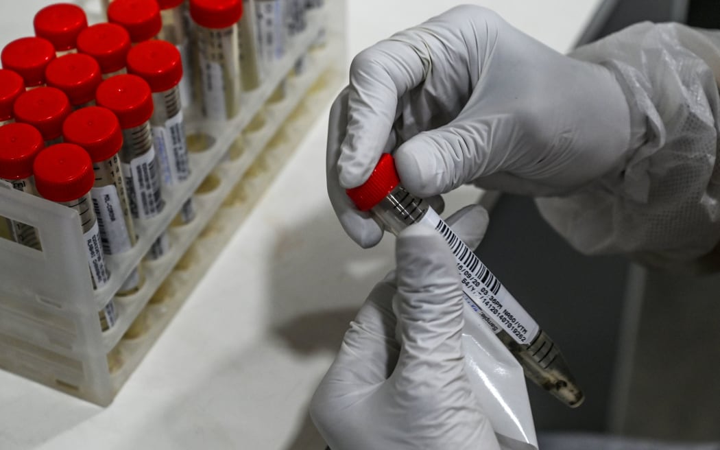 A laboratory staff sticks a barcode with UID (Unique Identity Number used in India) on samples collected for Covid-19 coronavirus testing