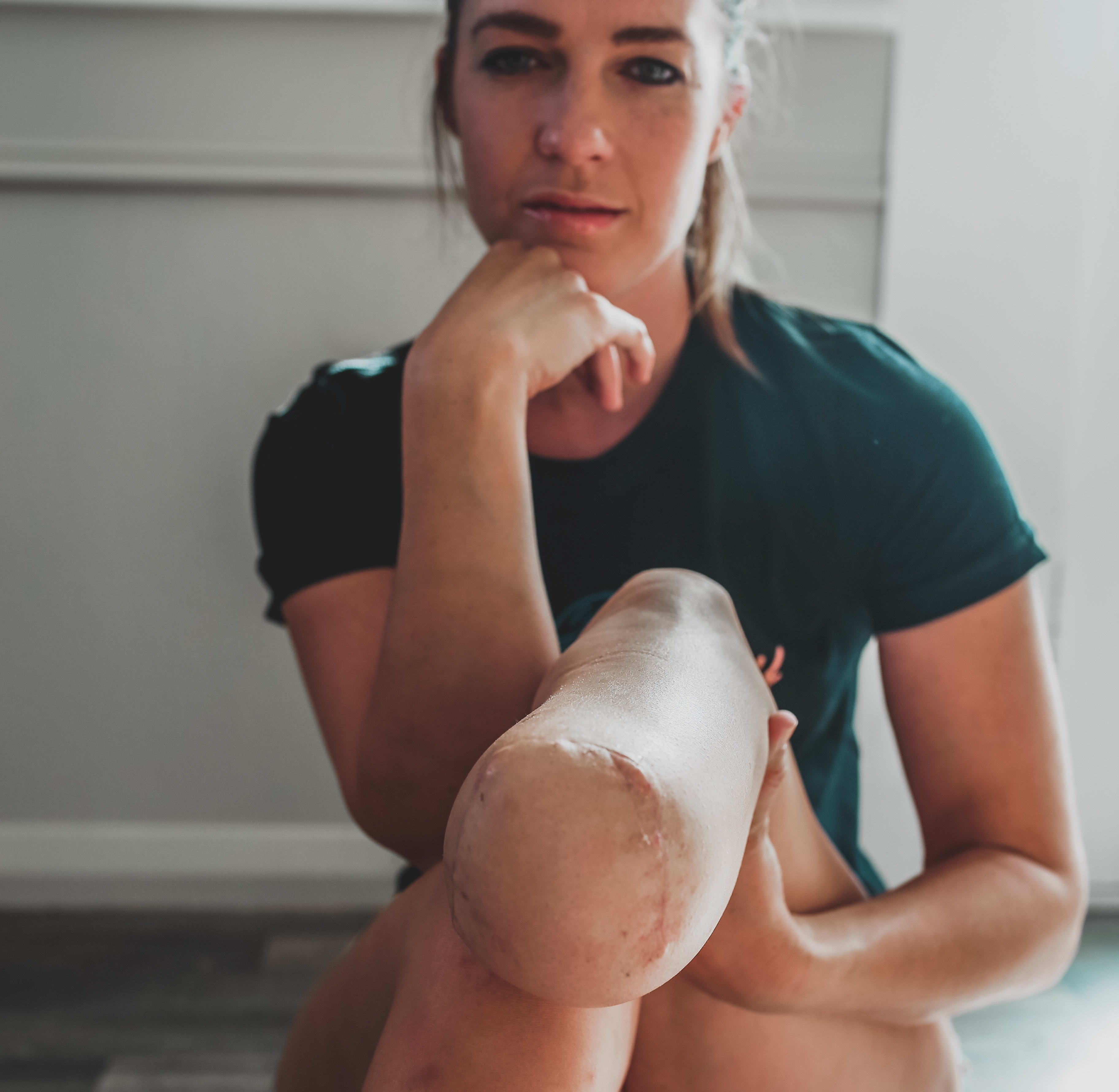 Rachel Maia post surgery
