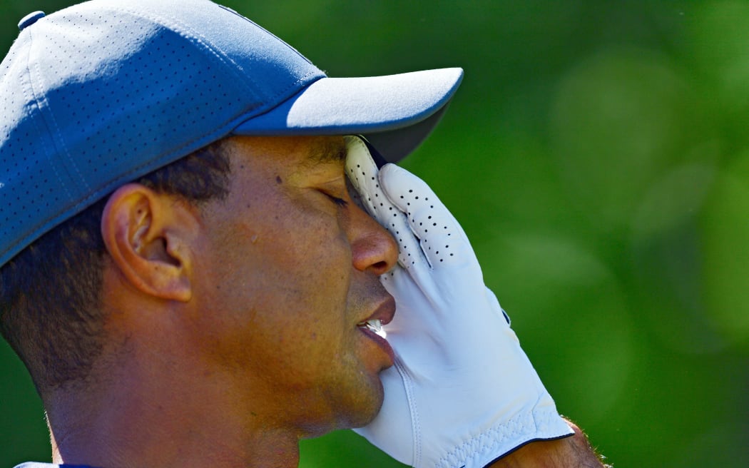 Tiger Woods.