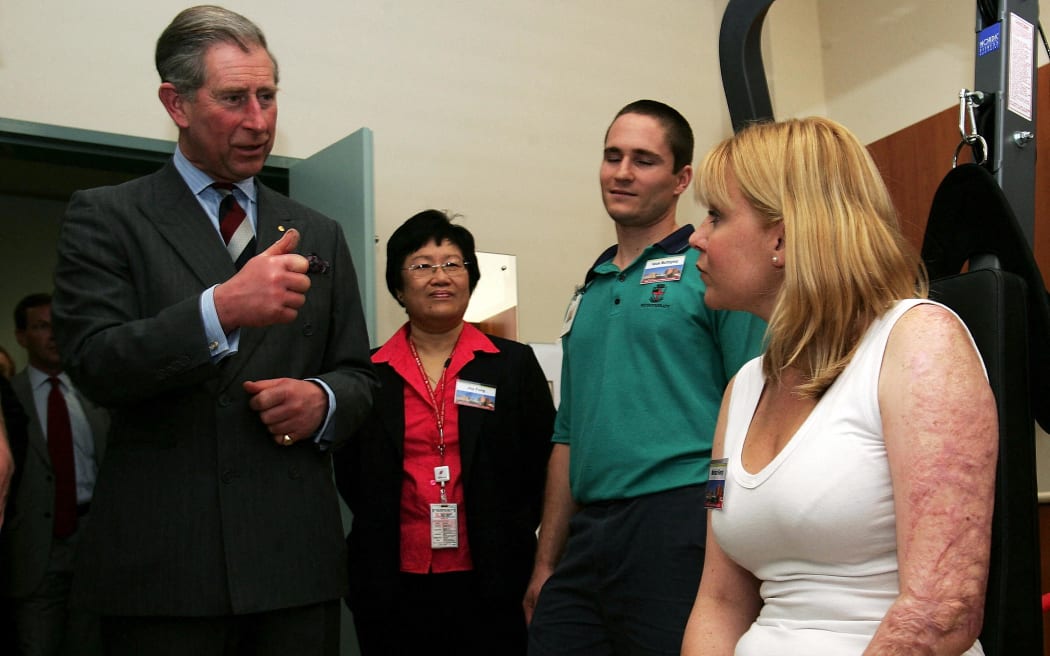 King Charles III (left), then prince, meets Bali bombing victim Melinda Kemp as he visits a rehabilitation room at the Royal Perth Hospital, in Perth on 1 March 2005.