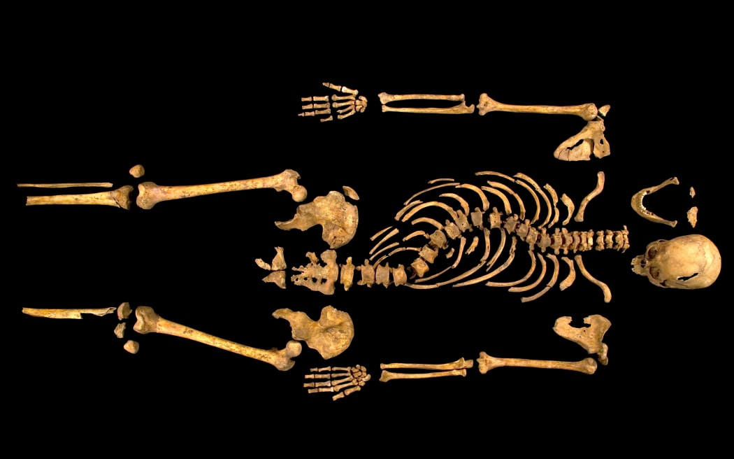 The skeleton of Richard III showing a curve in the spine.