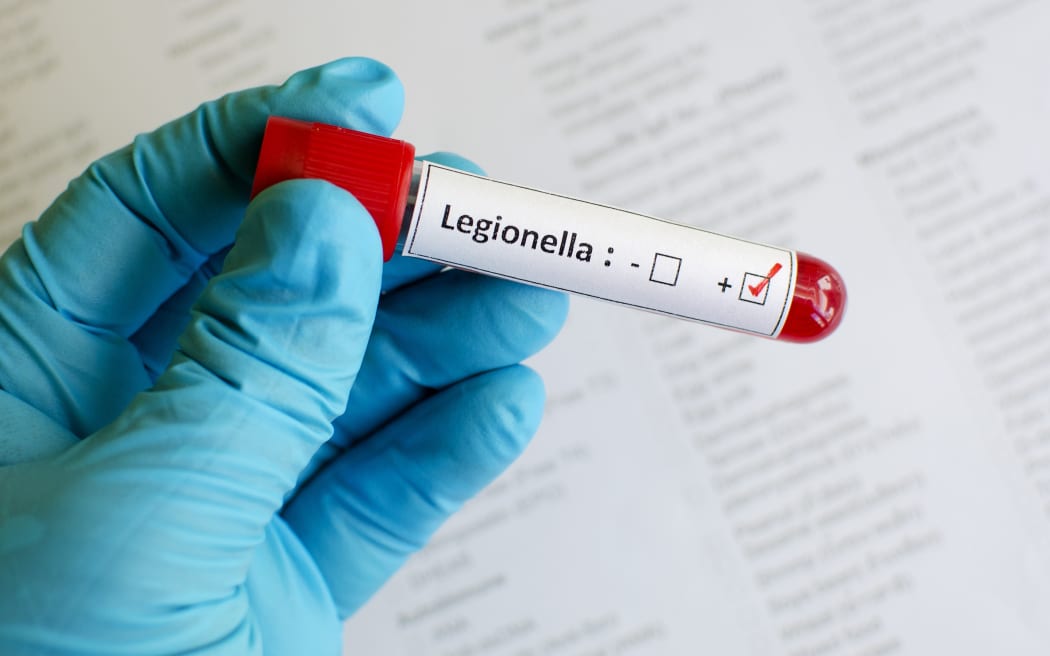 Legionnaires' disease test sample.