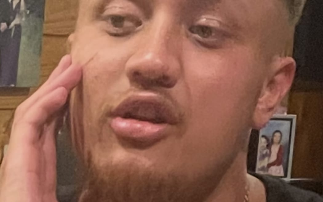 Police are seeking the public’s assistance to locate missing 23-year-old Liam.