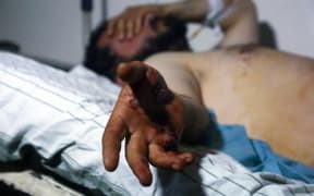 A man injured in the attack lies on a hospital bed in Hassakeh