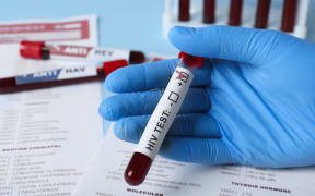 Scientist holding tube with blood sample and label HIV Test near laboratory form, closeup