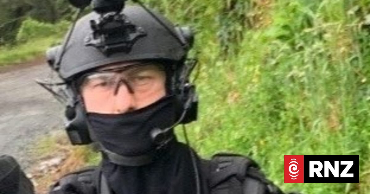 Shot cop's long recovery: 20 surgeries, pellets still in his face