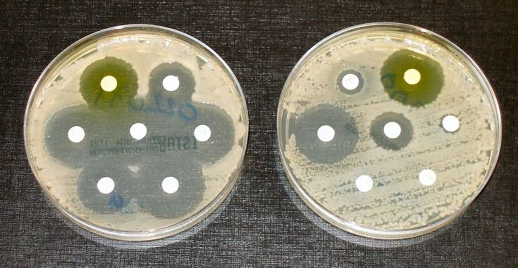 Money for research into discovering a solution for increased antimicrobial resistance is coming from crowdfunding.