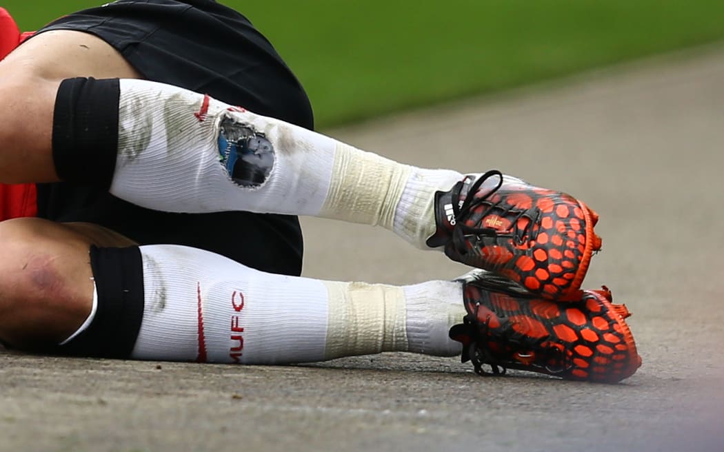 Why are football shin pads getting smaller? RNZ News