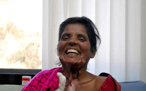 A woman under the care of Burns Violence Survivors in Nepal.
