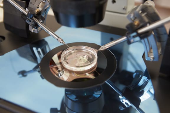 28155130 - laboratory fertilization of eggs in ivf treatment