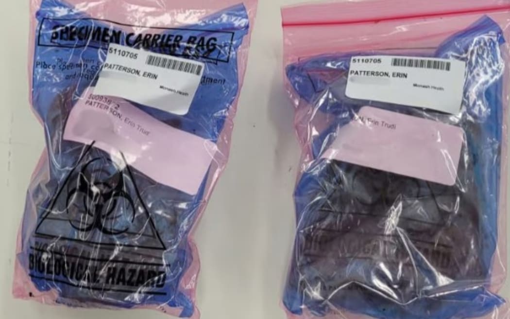 Beef Wellington leftovers were sent to the Victorian Institute of Forensic Medicine.
