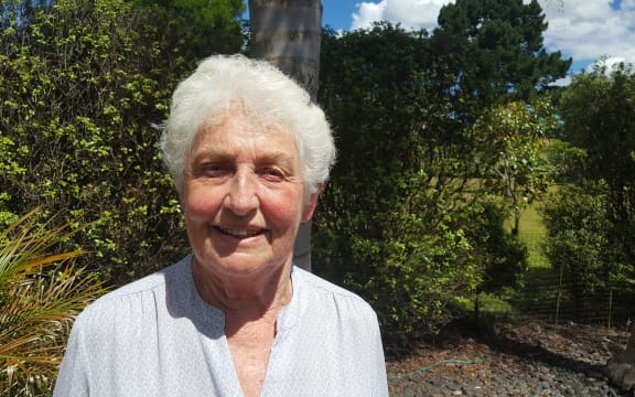 Hamilton woman Ngaire Mathews, who has received two Cochlear implants.