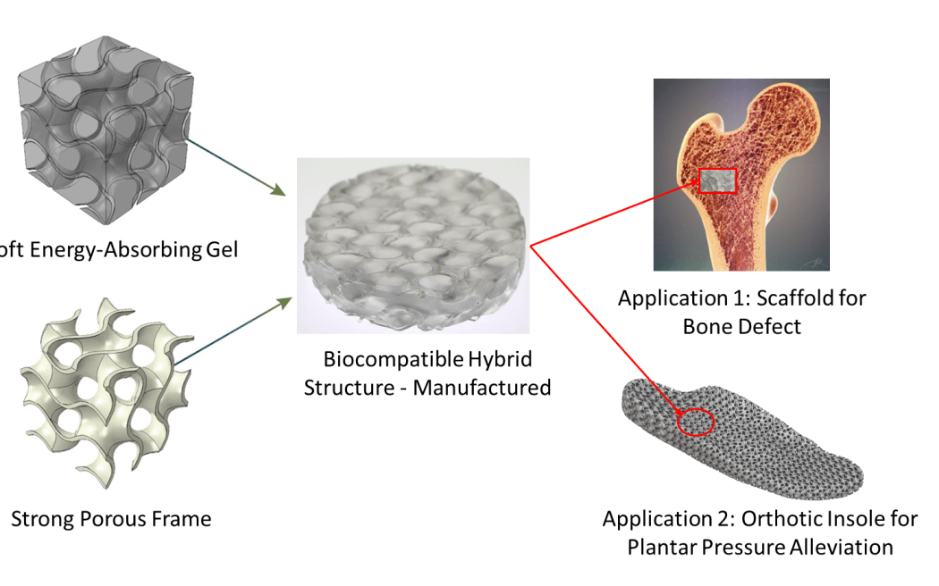 Graphic with five images  showing  3-D printed  cell structures plus gell structure for bone supports and orthotics