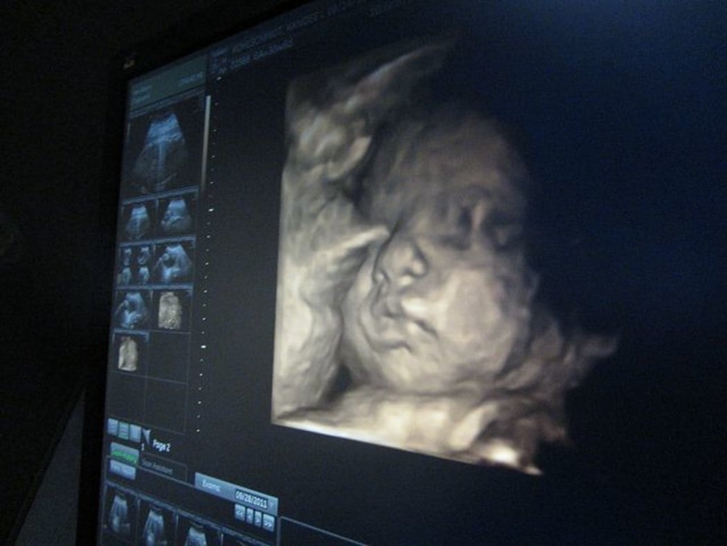 Baby Good 3d Ultrasound