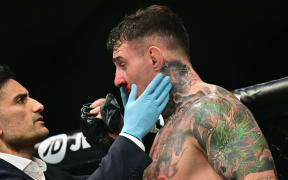 Britain’s Tom Aspinall gets checked after being hit in the eye while fighting  France’s Ciryl Gane during their UFC heavyweight title bout at UFC 321 at Etihad Arena in Abu Dhabi early on October 26, 2025. (Photo by Giuseppe CACACE / AFP)