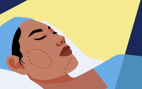 Cosmetic surgeons are reporting a growing number of patients with sagging skin and facial hollowing after losing weight with drugs.