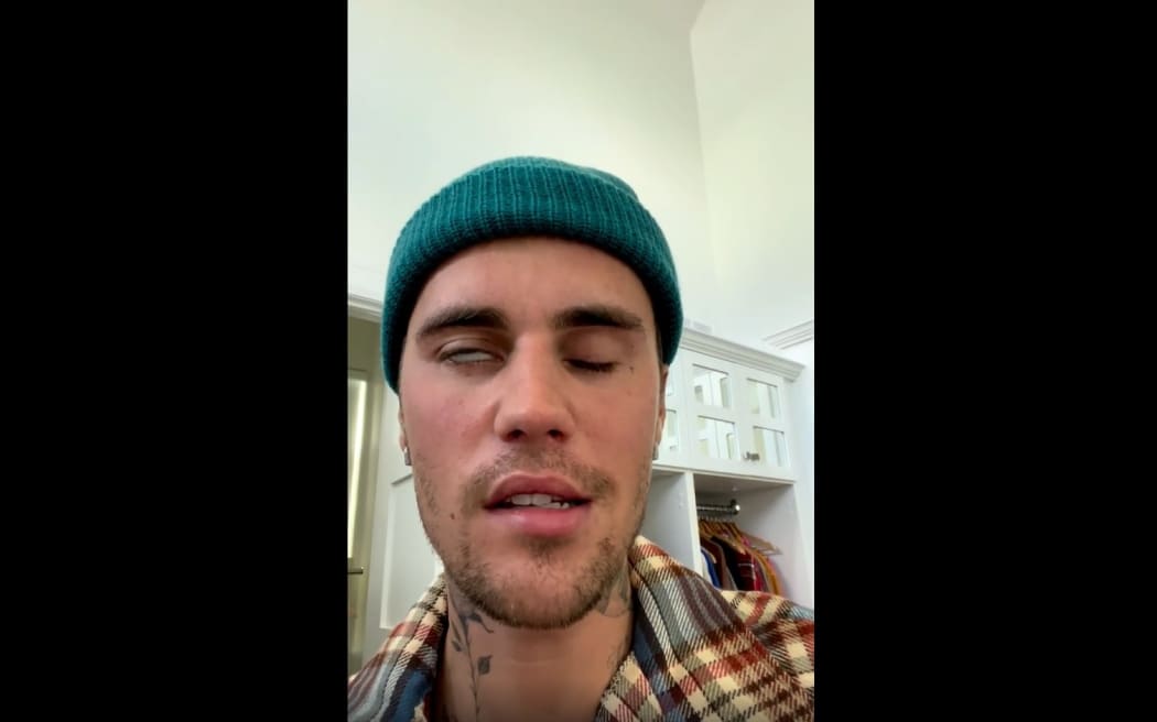 Justin Bieber has been diagnosed with Ramsay Hunt syndrome.