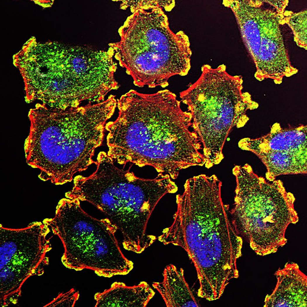 Molecular basis for melanoma cell motility