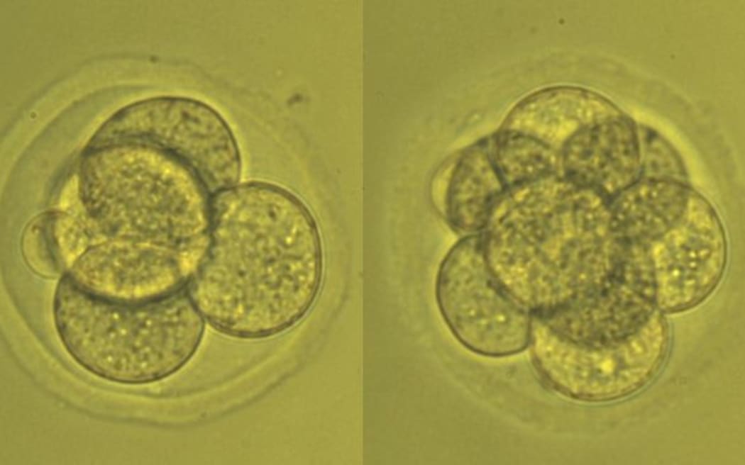 Fertility researcher Melanie Olds photographed a very early embryo as it doubled from two to eight cells.
