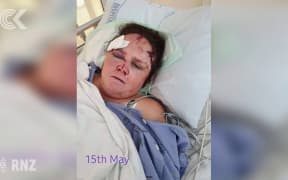 Calls to better protect hospital staff after guard brutally attacked