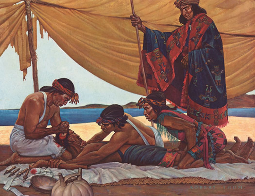 A lithograph depicting trepanation performed by a first century Peruvian physician, from a portfolio by Robert Thom illustrating the history of medicine.