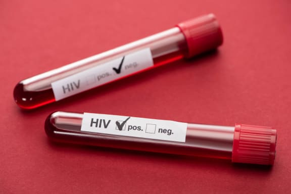 selective focus of negative and positive hiv blood sample test on red background