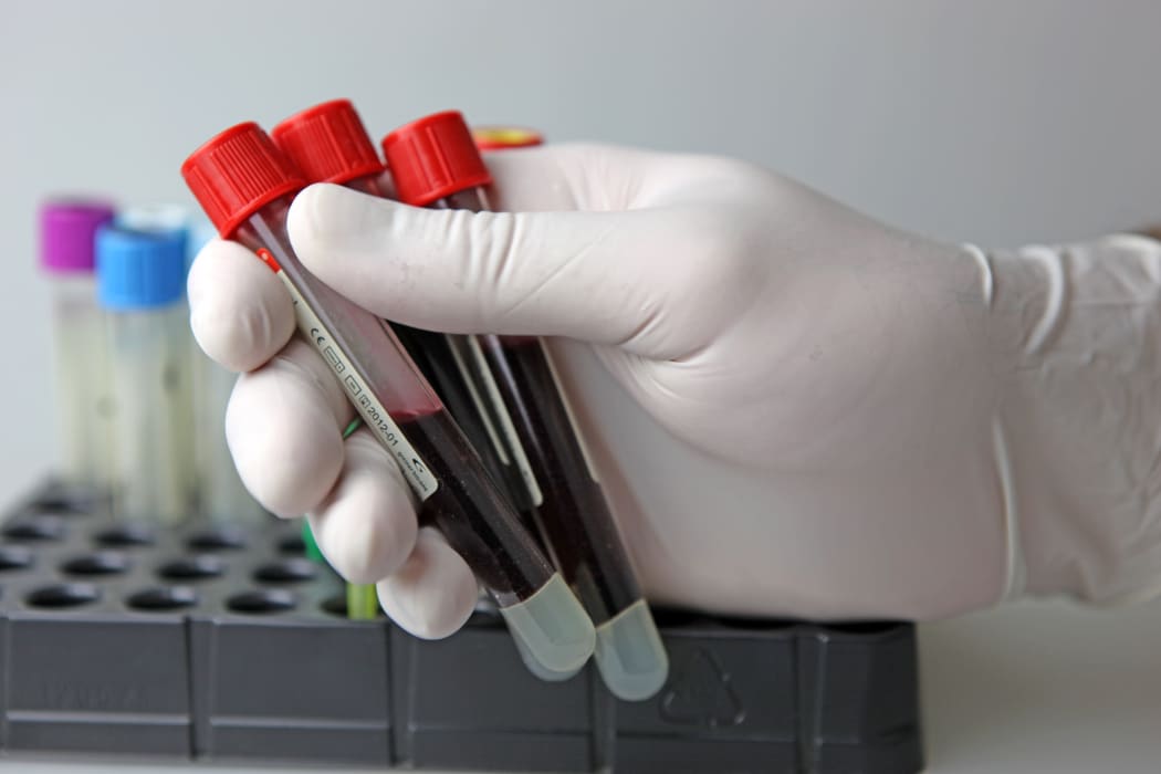 A scientist holds three test tubes filled with blood in a laboratory.
