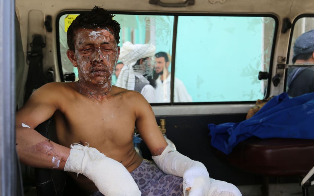 An injured Afghan man sits in an ambulance in Ghazni following the accident on the main Kabul-Kandahar Highway.