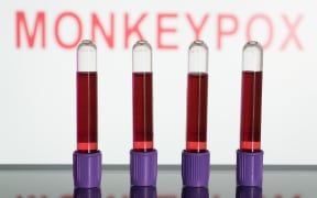 In this photo illustration,  blood test vials are seen in front of a screen that says ''Monkeypox'' (Photo illustration by Nikos Pekiaridis/NurPhoto) (Photo by Nikos Pekiaridis / NurPhoto / NurPhoto via AFP)